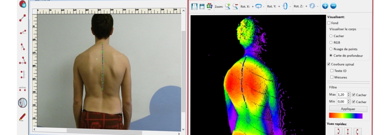Modélisation Musculo-Squelettique Personnalisée du Rachis Cervical 