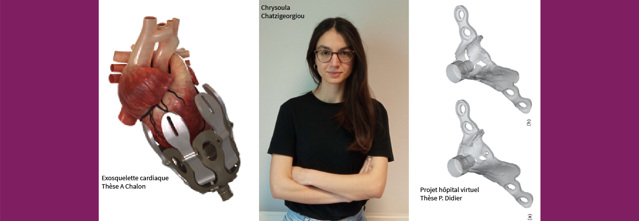 Implants biomimétiques, exosquelette cardiaque ou encore hôpital virtuel : voici quelques projets en lien avec la santé sur lesquels peuvent travailler les chercheurs du LEM3