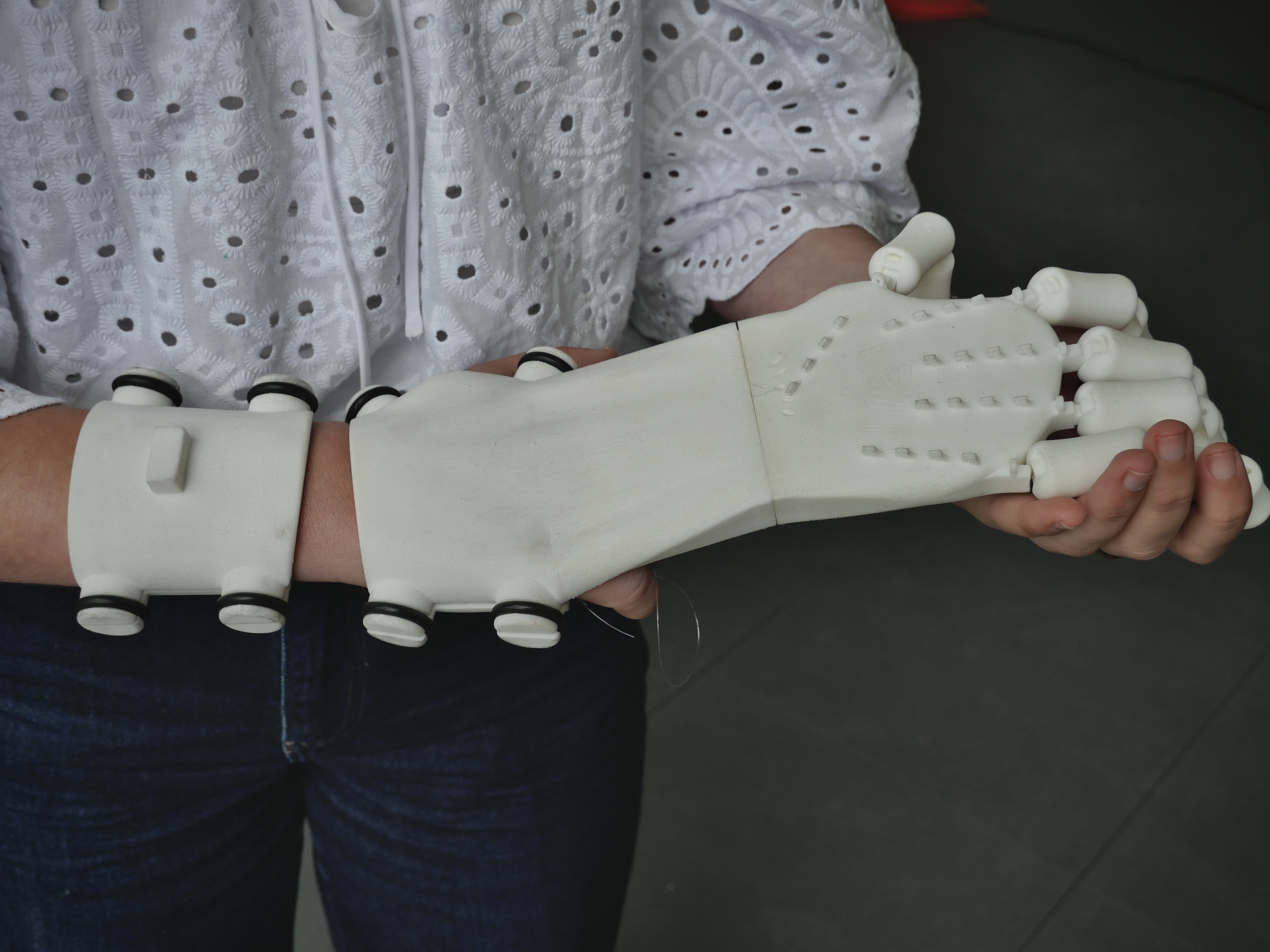 prothèse main en fabrication additive