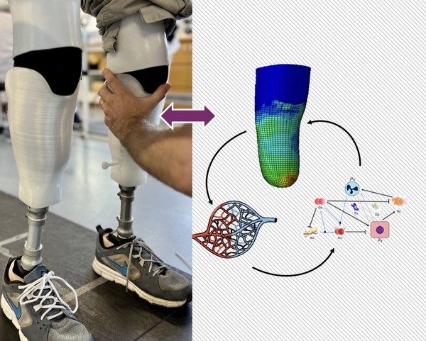 Les retombées de TWIN-IT concernent les prothèses, les orthèses, les exosquelettes ou encore les fauteuils roulants.