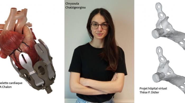 Implants biomimétiques, exosquelette cardiaque ou encore hôpital virtuel : voici quelques projets en lien avec la santé sur lesquels peuvent travailler les chercheurs du LEM3